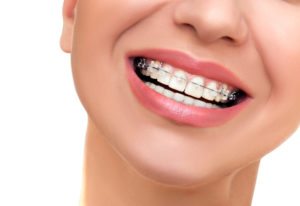 Six-Month-Smiles